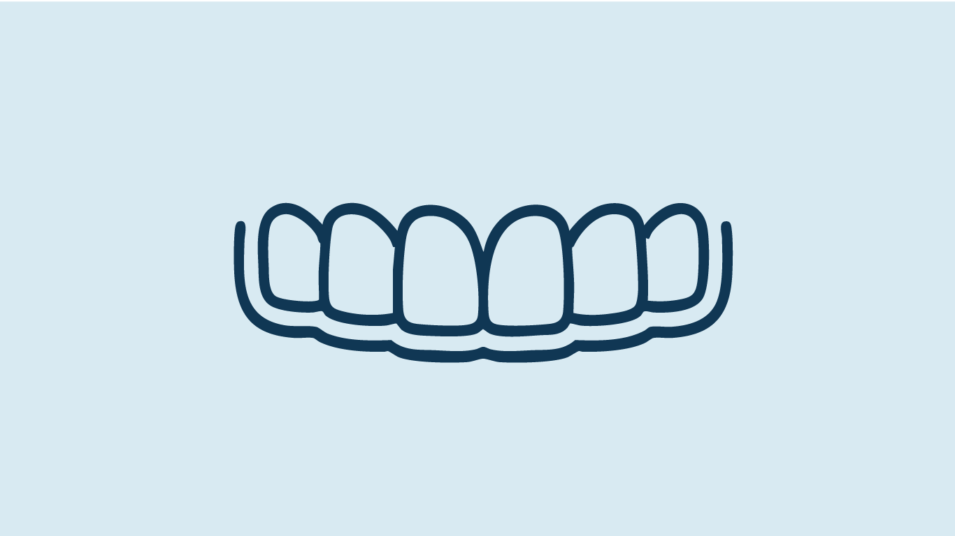 Illustration de gouttières transparentes
